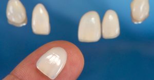 Diferenças entre Facetas e lentes de contacto - Médico dos Dentes