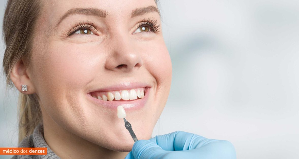 Facetas dentárias- Médico dos Dentes