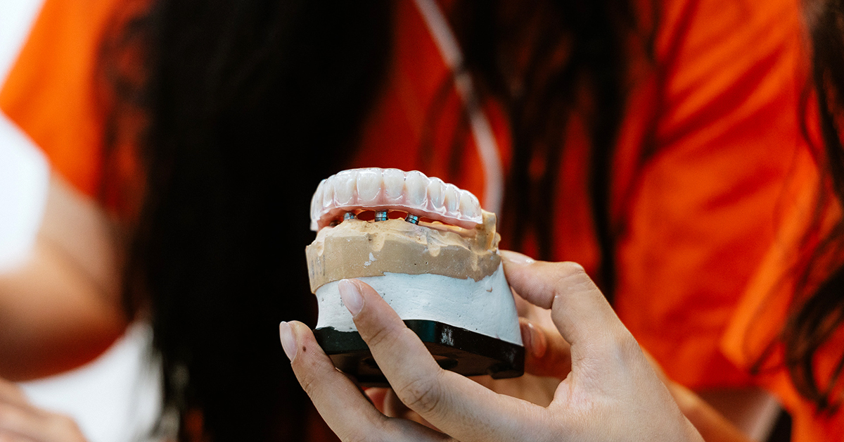 Titânio nos implantes: porque é que se utiliza? - Médico dos Dentes