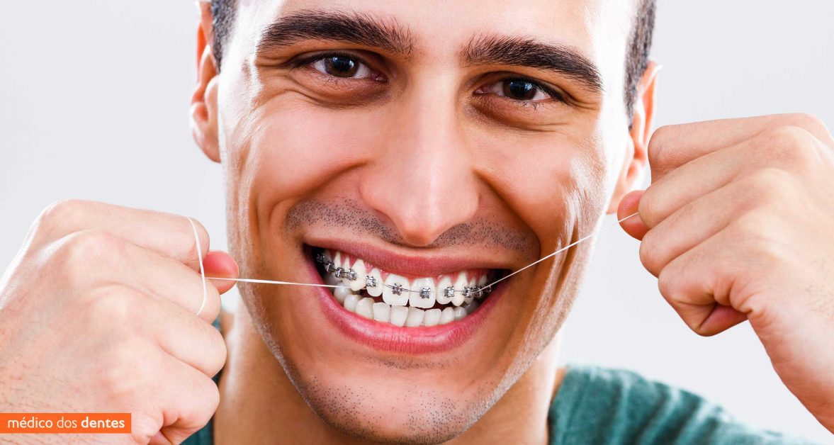 Limpeza do aparelho dentário fixo - Médico dos Dentes