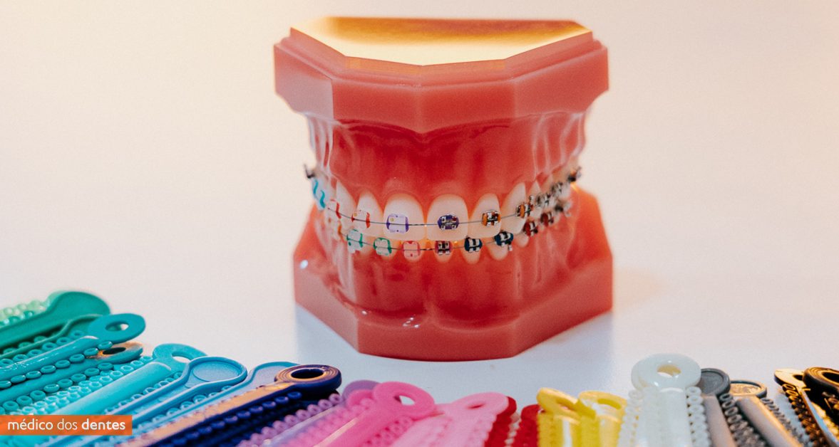 Aparelho dentário no Médico dos dentes