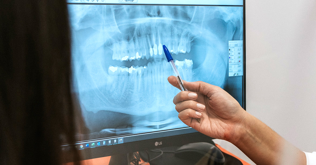 A ortopantomografia deteta se tiver um quisto dentário?