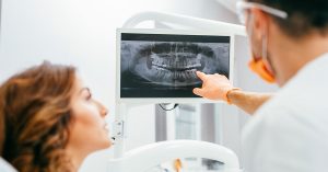 Motivos para ter cáries- Médico dos Dentes